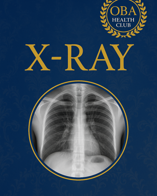 X-Ray