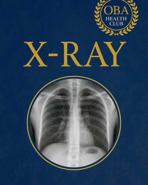 X-Ray