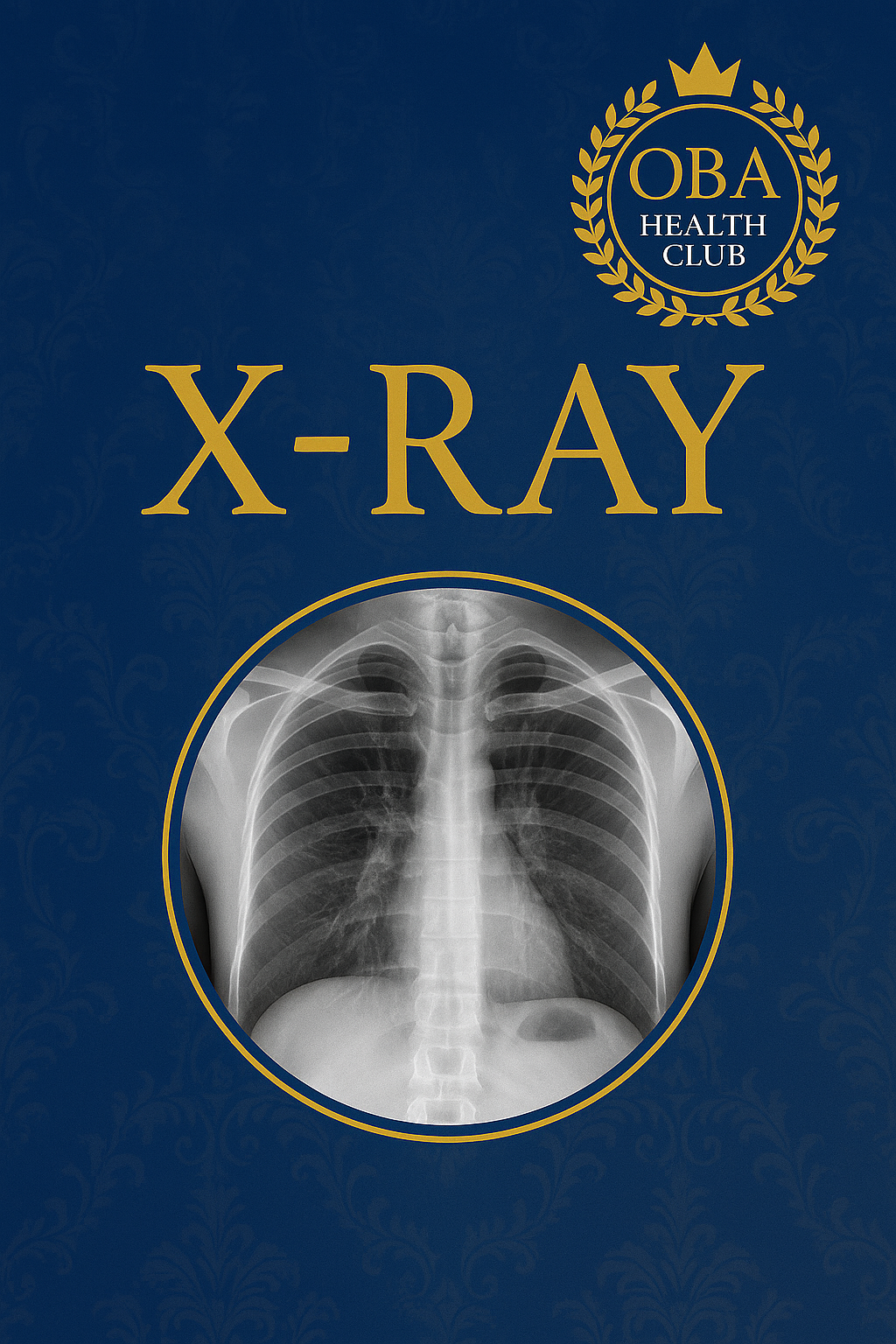 X-Ray